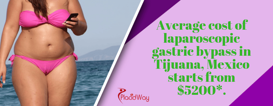 average cost of laparoscopic gastric bypass in Tijuana, Mexico starts from $5200.